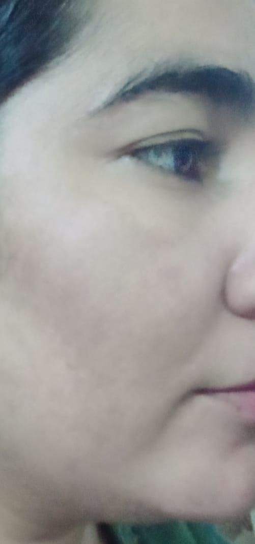 Customer photo review of Cerulic Glow Boosting Serum