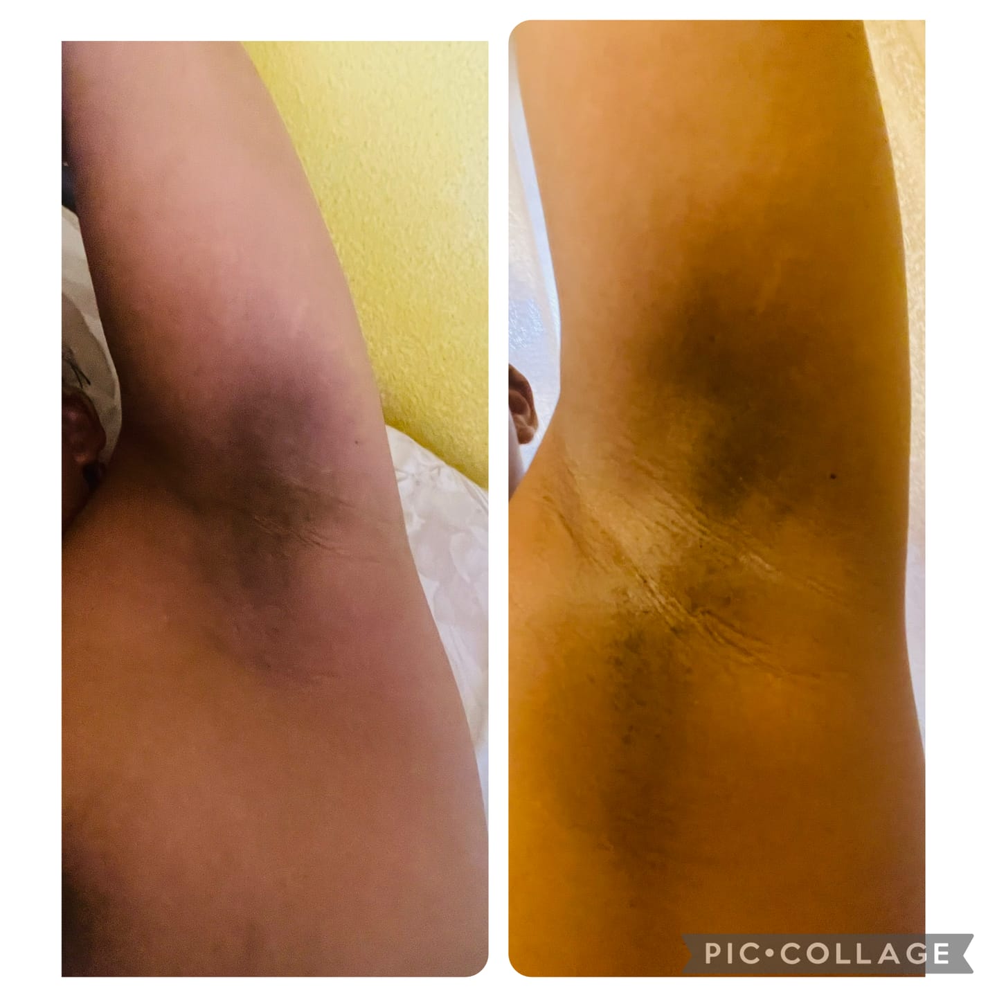 Customer photo review of Bright Skin Bish