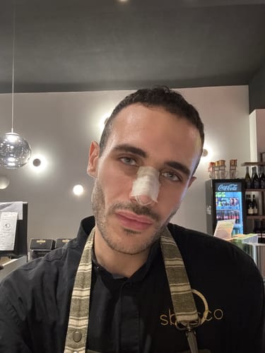Customer photo review of Ice