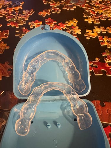 Customer photo review of File Your Smile (A Digital Copy of Your Impressions For Future Replacement Products)