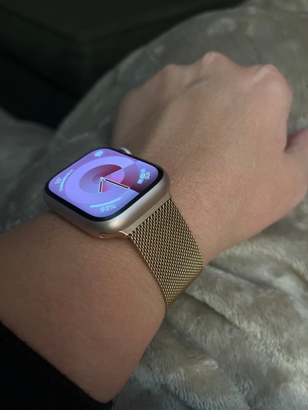 Customer photo review of Vicenza Magnet Band