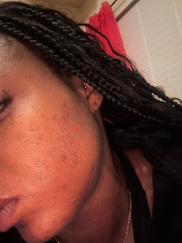 Customer photo review of 2-1 Bar | Half Oat exfoliant | Half Discoloration Cleanser