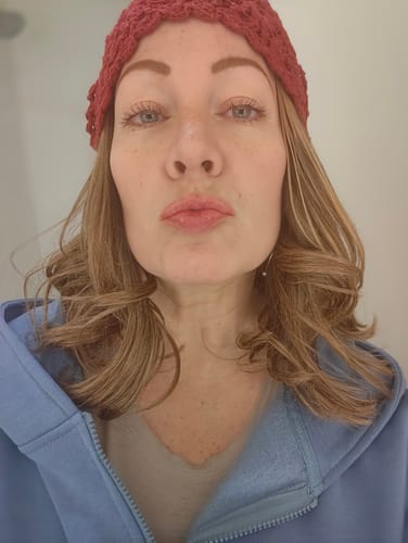 Customer photo review of La La Lips - Moisturizing Lip Balm