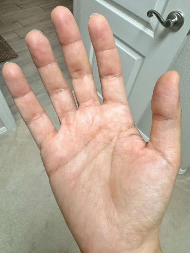 Customer photo review of Women's Gut Rebalance Kit