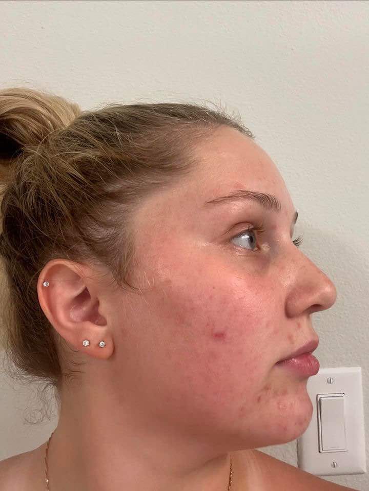 Customer photo review of Women's Gut Rebalance Kit