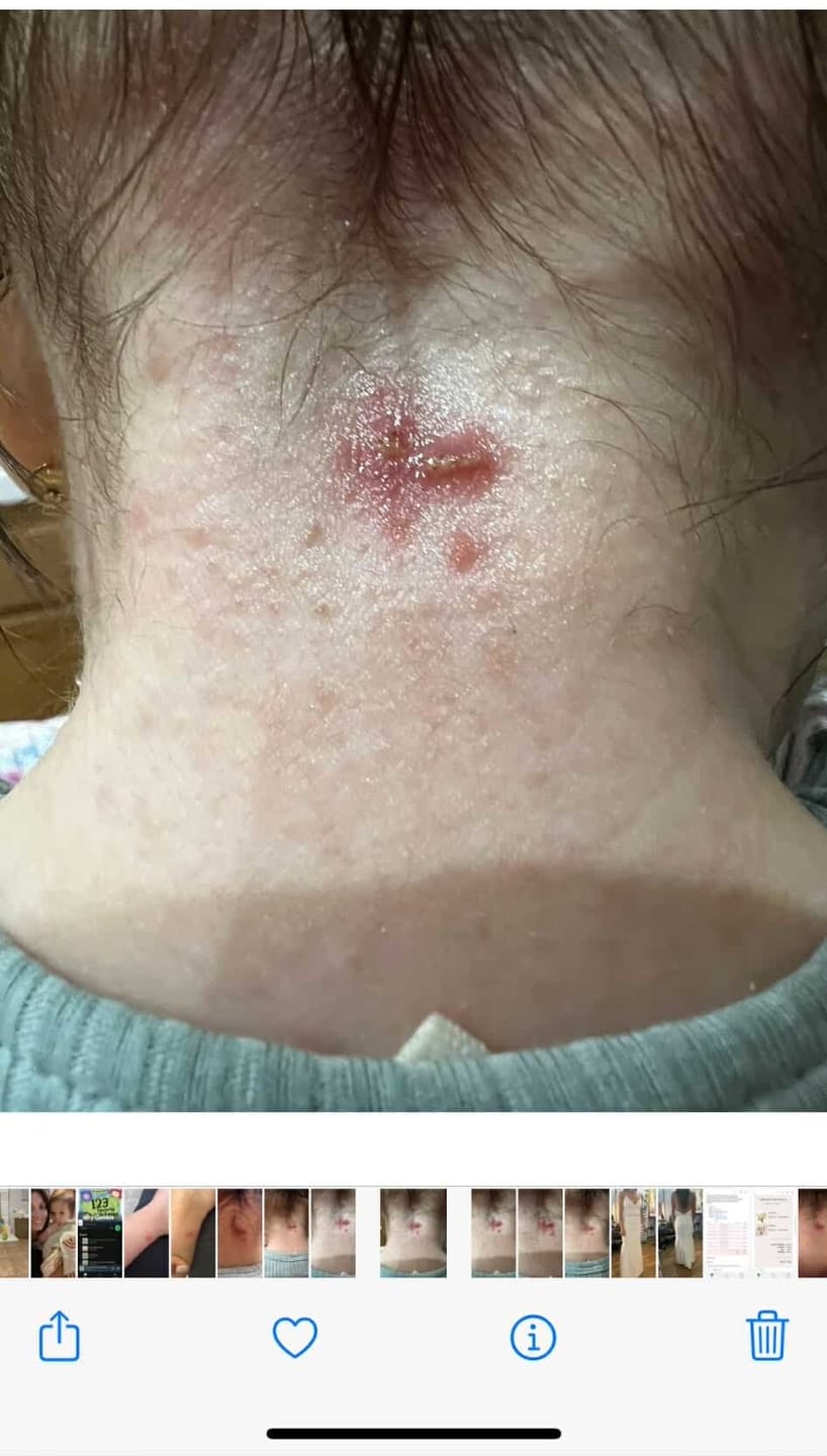 Customer photo review of Relieve Healing Gel