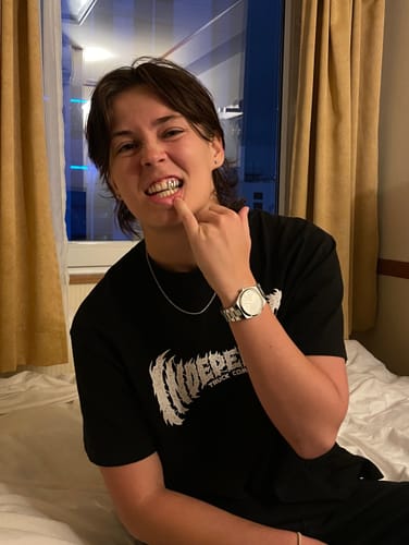 Customer photo review of PRISM (SILVER GRILLZ)