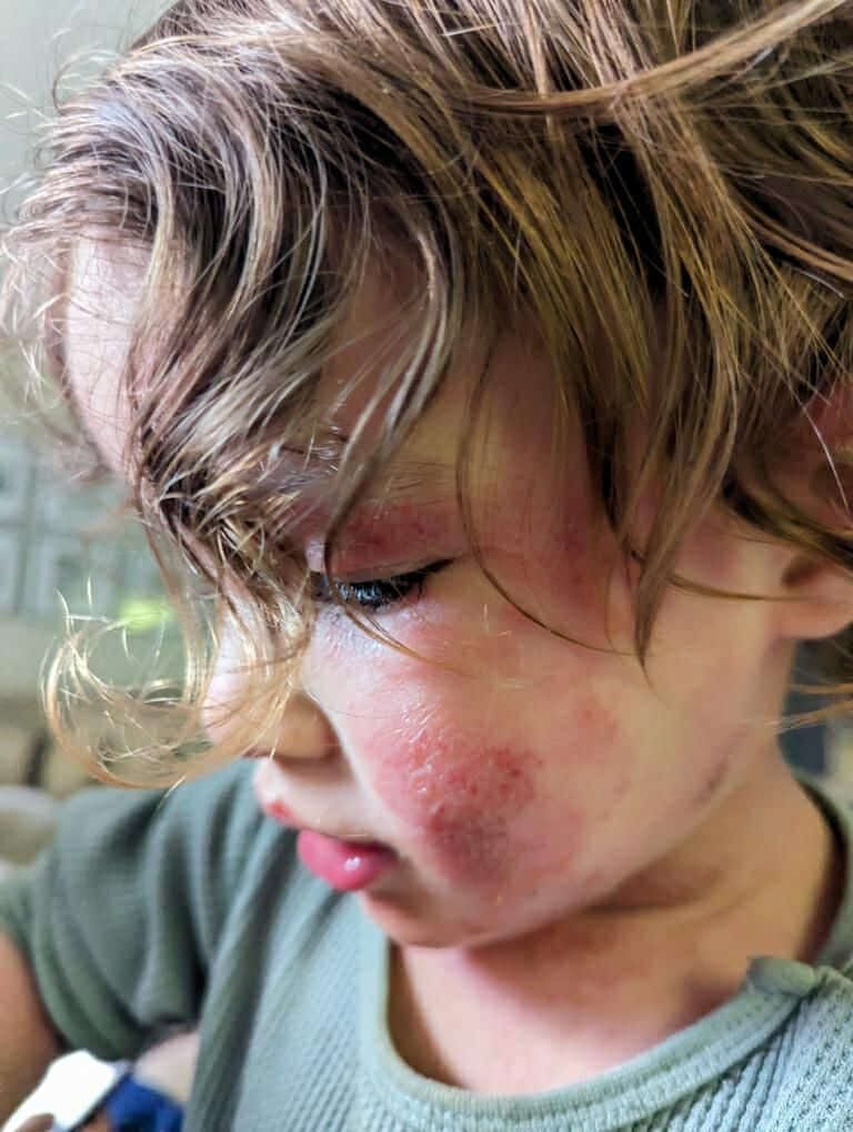 Customer photo review of Children’s Gut Rebalance Kit