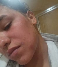 Customer photo review of Instant Hair Removal Kit