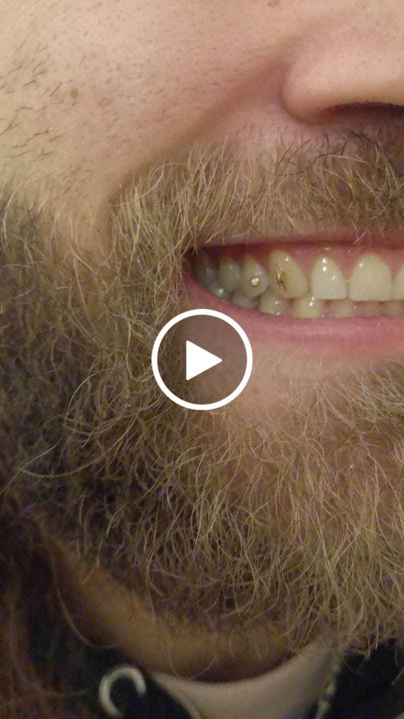 Customer video review of Bolt 22-karat gold
