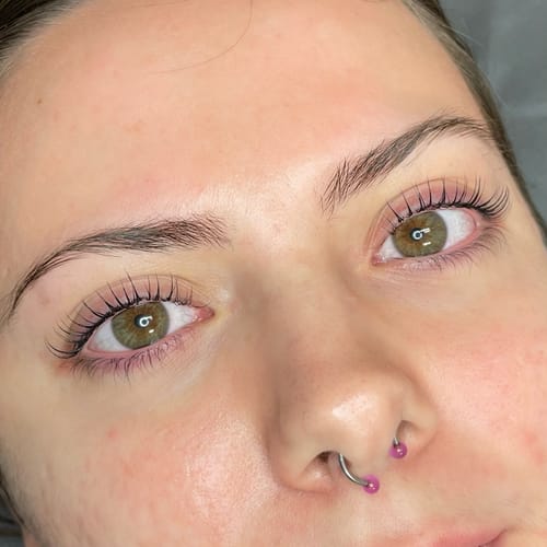 Customer photo review of Glue-Free Flexi Shields