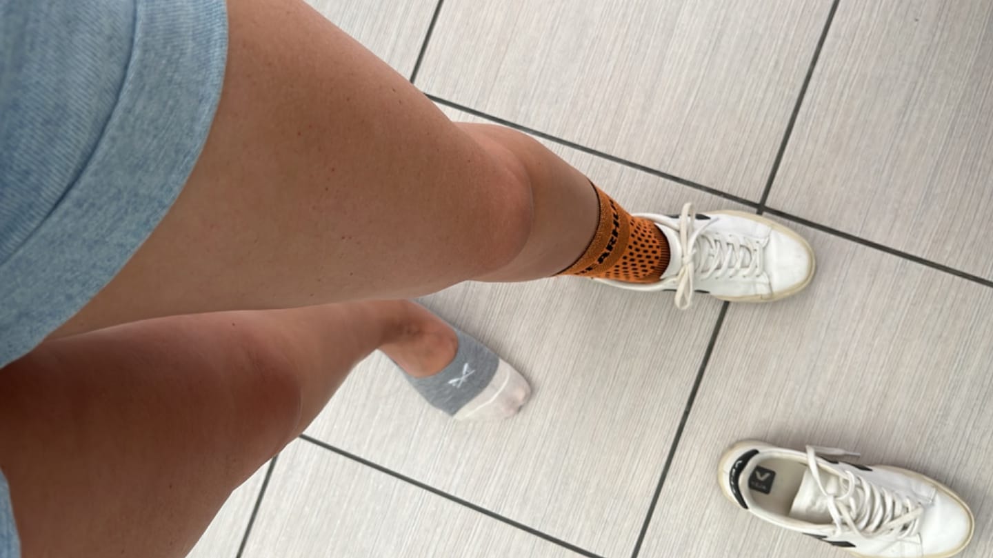 Customer photo review of Bamboo Ankle Compression Support Sleeve For Achilles Tendon And Ankle Sprains
