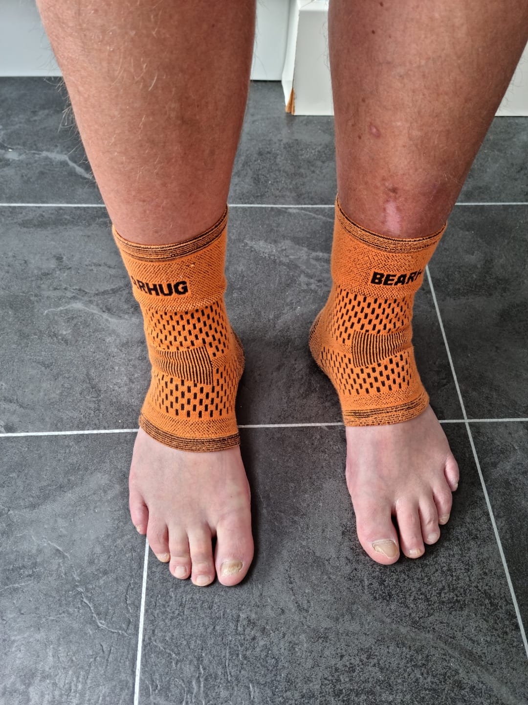 Customer photo review of Lowers Active Pack
