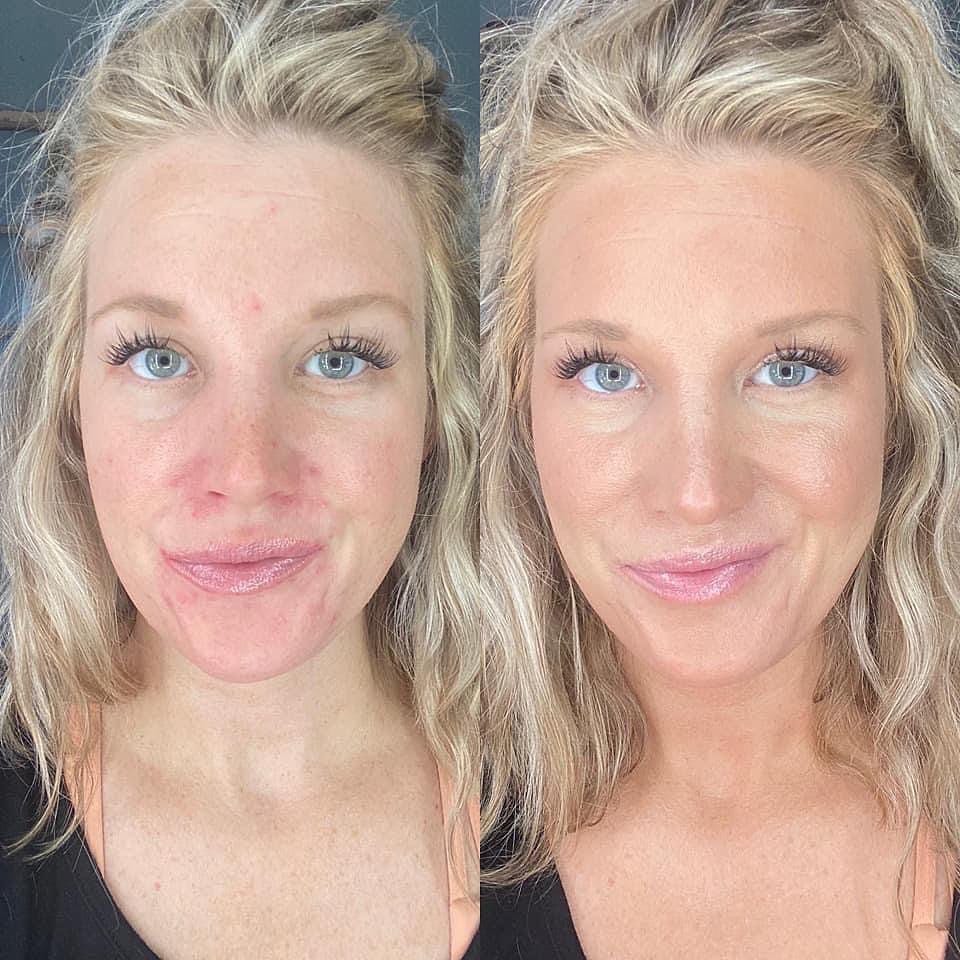 Customer photo review of Nuvee® Changing Foundation