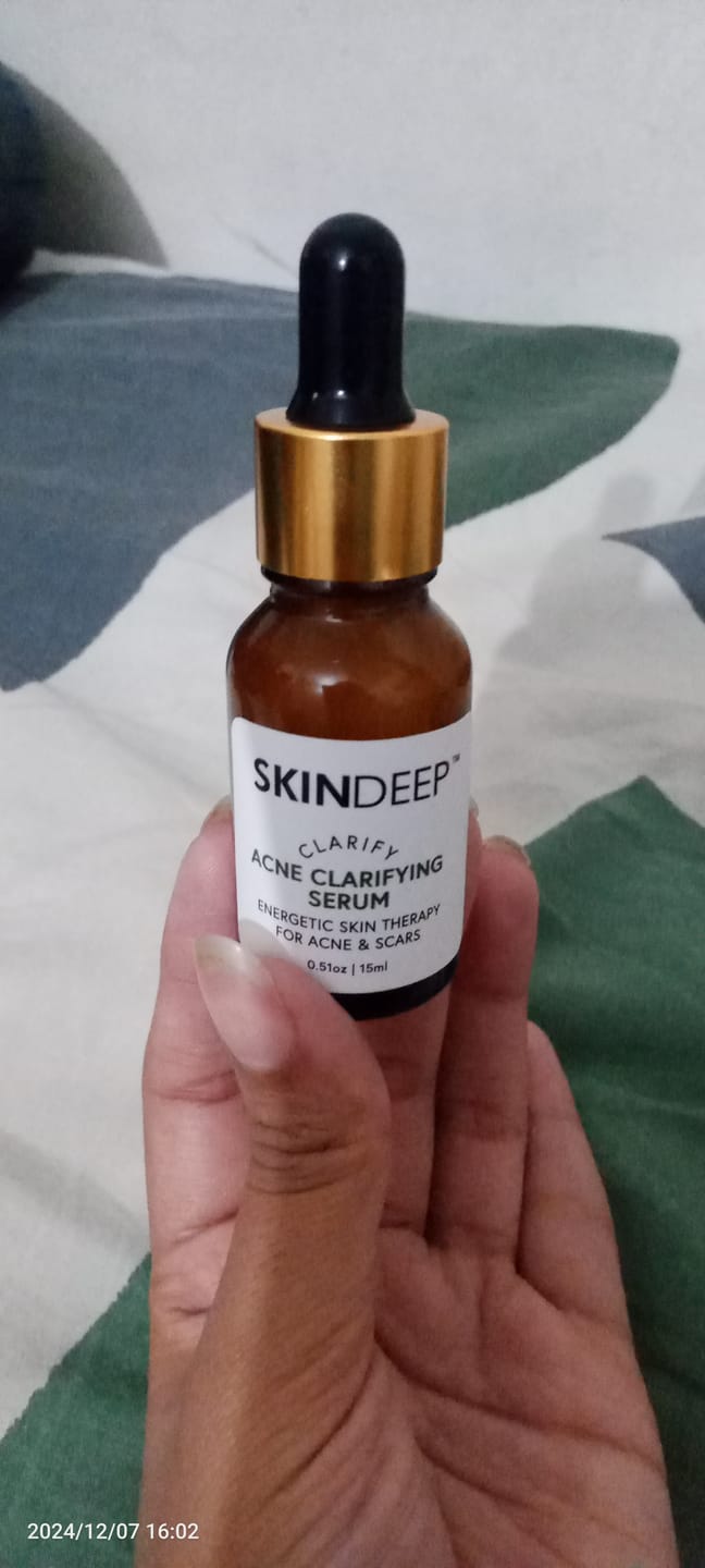 Customer photo review of ACNE CLARIFYING SERUM - Energetic Skin Therapy for Acne & Scars