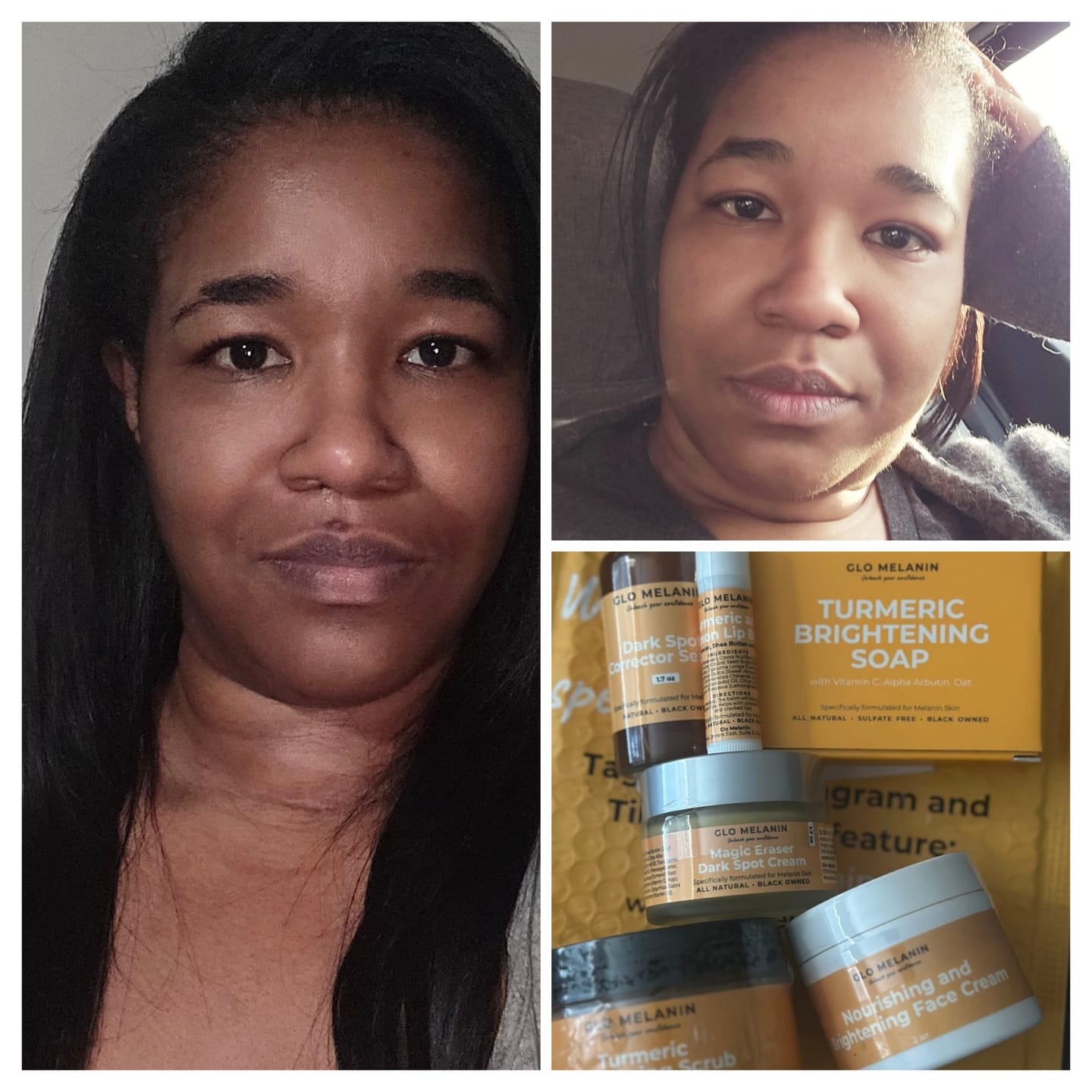Customer photo review of Dark Spot Corrector Serum