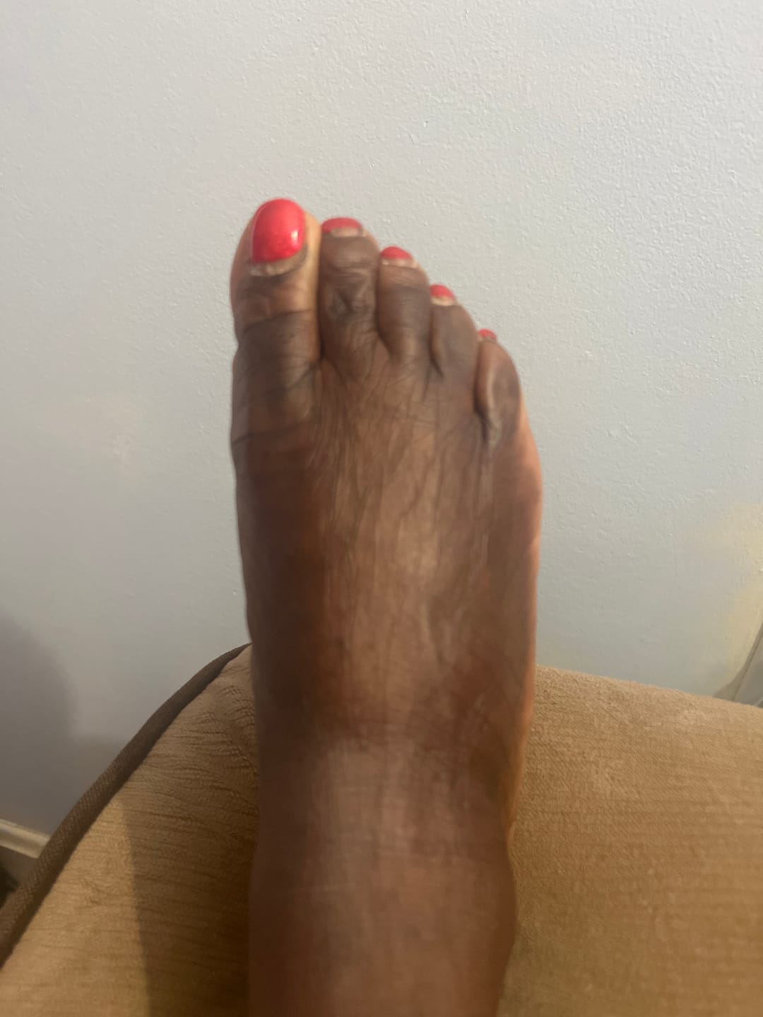 Customer photo review of Intense Discoloration Treatment (Rapid Action)