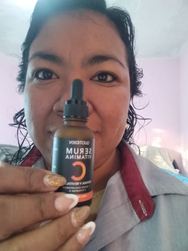 Customer photo review of Kit Los Esenciales (47% OFF) - Serum de Vitamina C 30ml + Serum de Niacinamida 30ml + Serum de Ácido Hialurónico 30ml