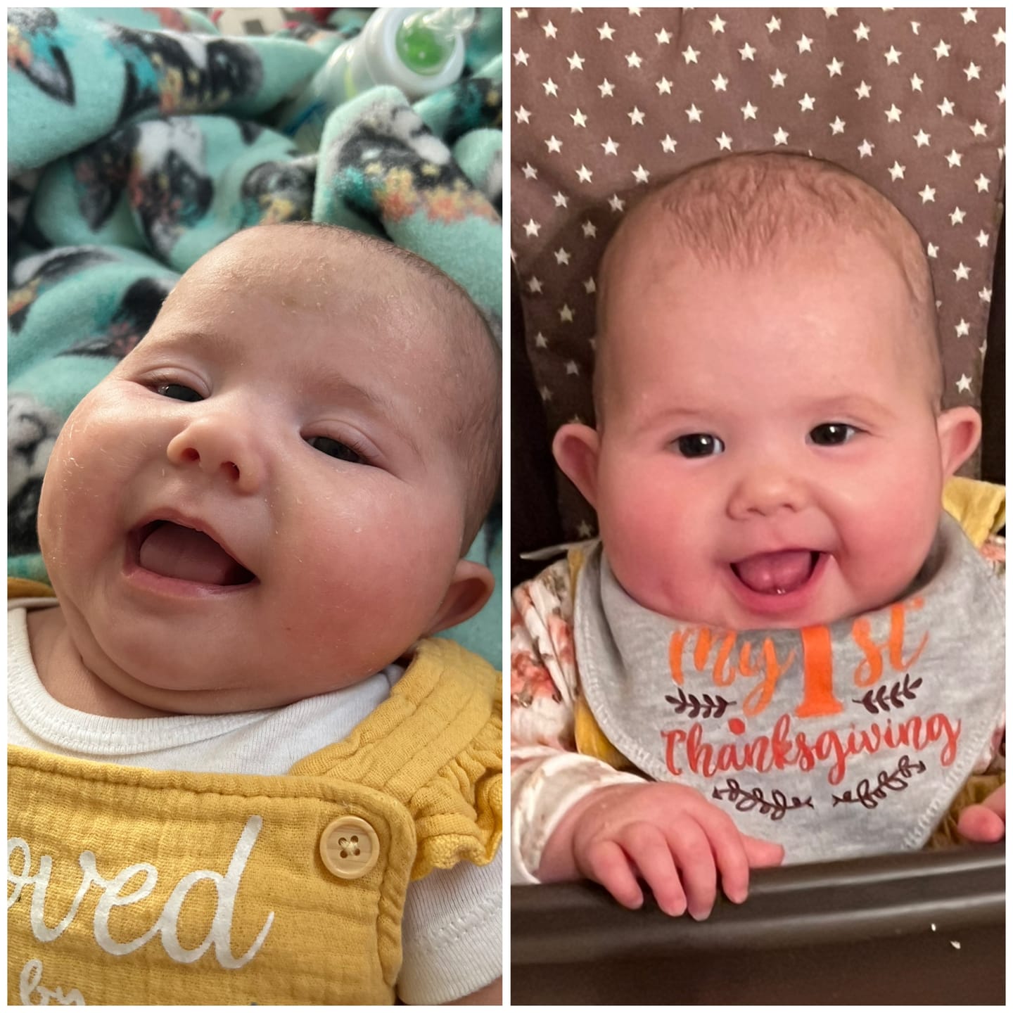Customer photo review of Soothe Stick Skin Balm Stick for Eczema and Dry, Cracked Skin, Soothing effect for itch and irritation