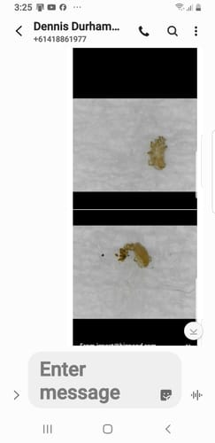 Customer photo review of Para Cleanse Detox Pack