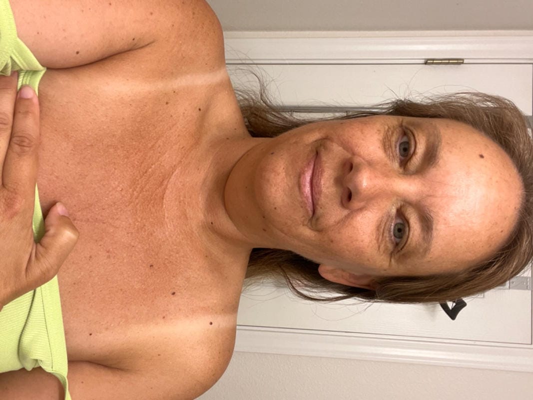 Customer photo review of Prestige Tans: Tanning Nasal Spray