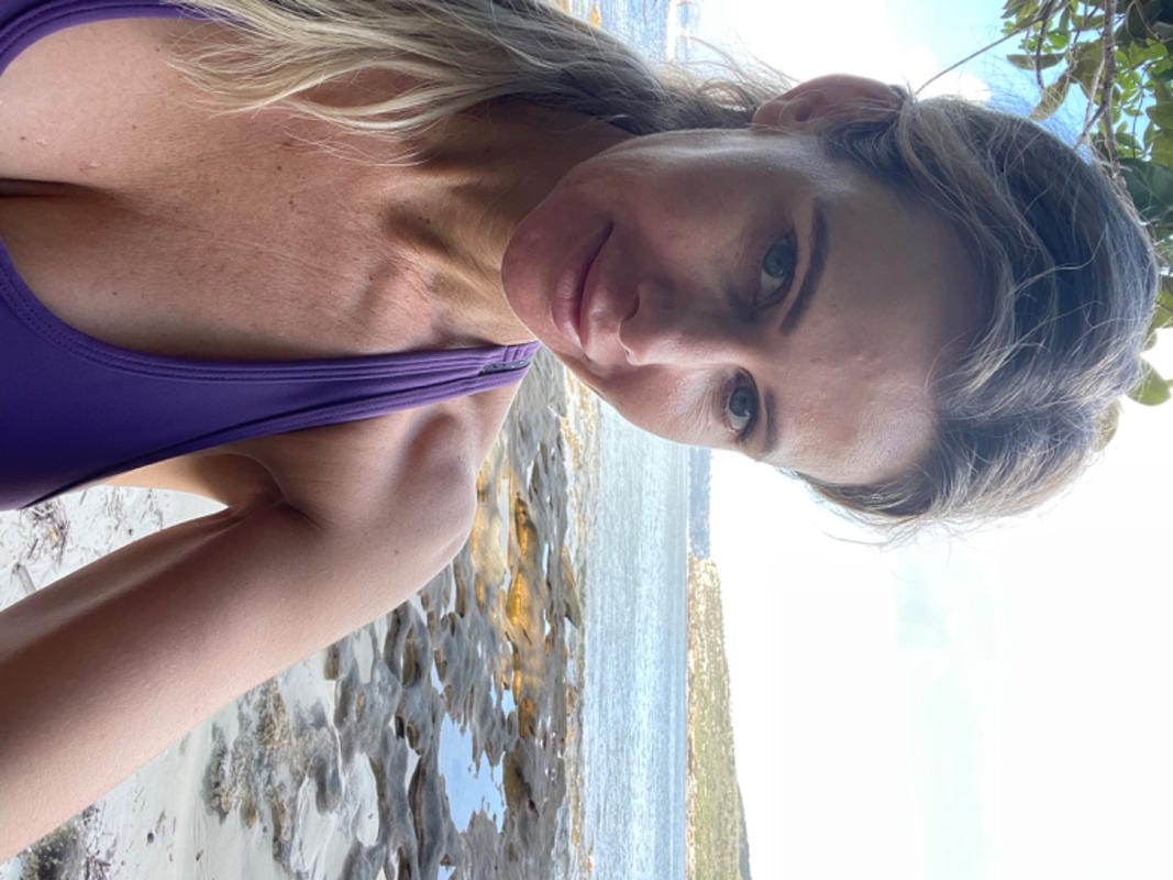 Customer photo review of Prestige Tans: Tanning Nasal Spray