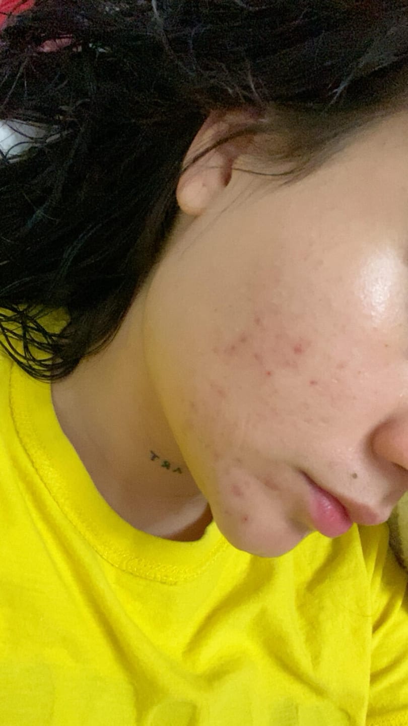 Customer photo review of A.O.X Booster Antioxidante con vitamina C