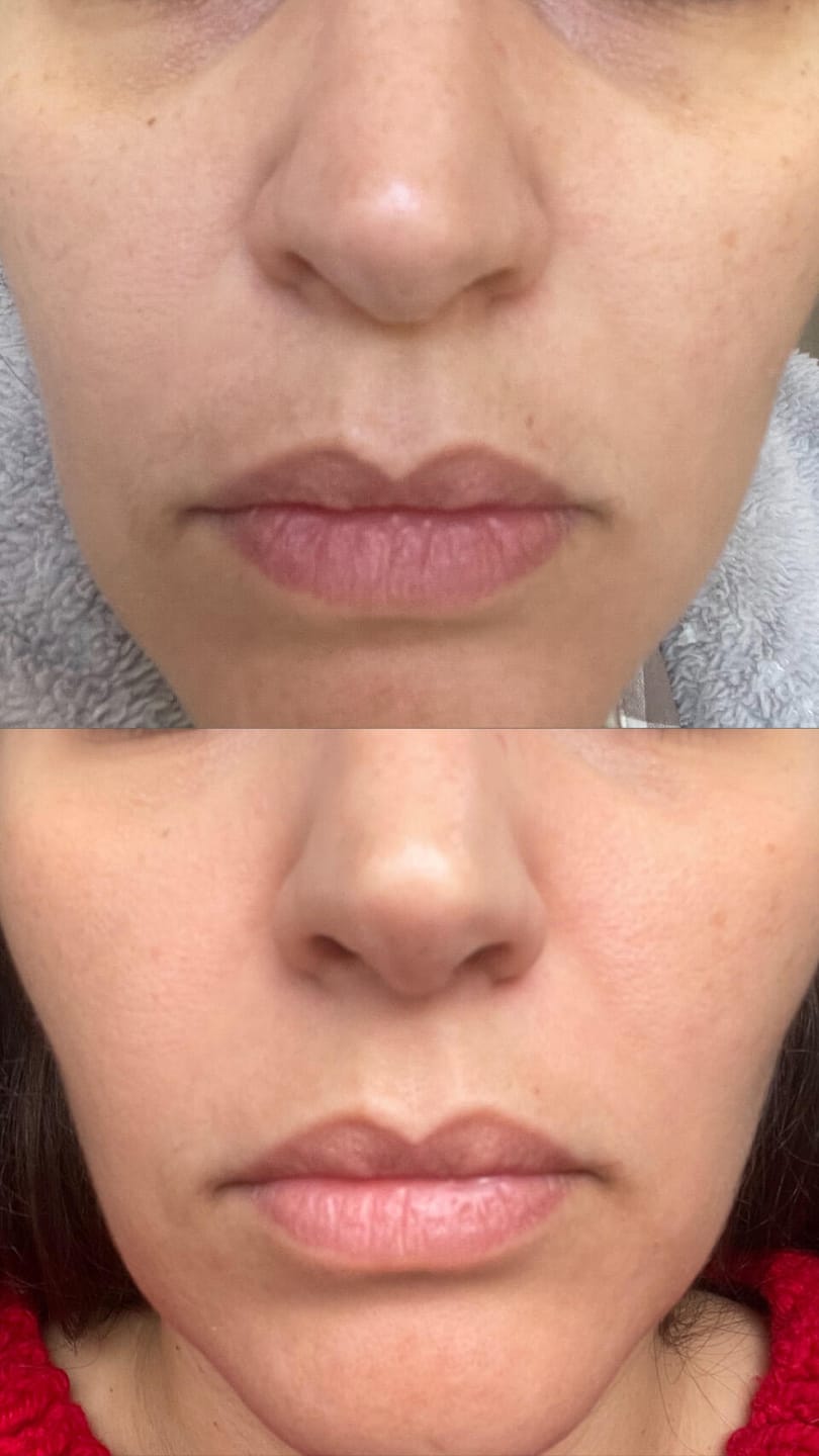 Customer photo review of RUTINA AM&PM - GRANITOS + MARCAS + POROS + MANCHAS + ARRUGAS