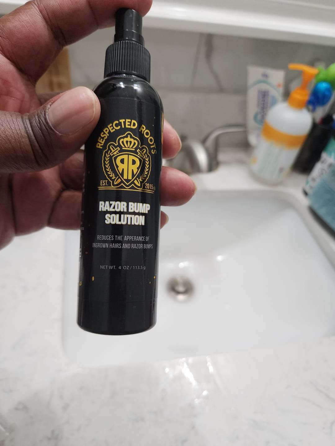 Customer photo review of Razor Bump Solution