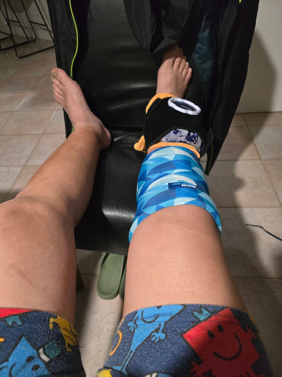 Customer photo review of Large Hot & Cold Compression Gel Sleeve