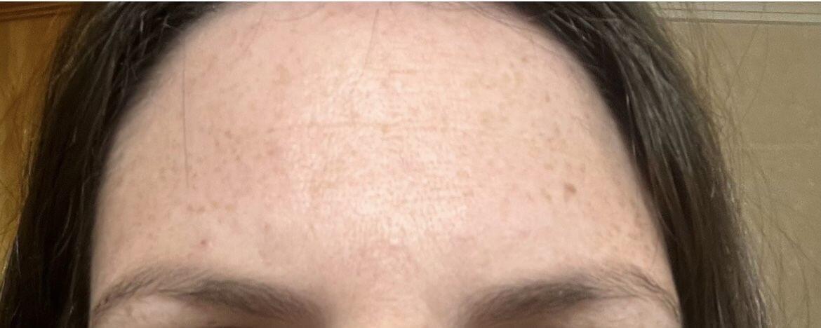 Customer photo review of A.O.X Booster Antioxidante con vitamina C