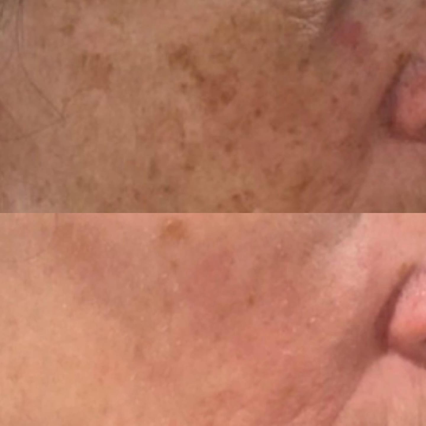 Customer photo review of RUTINA AM&PM - GRANITOS + MARCAS + POROS + MANCHAS + ARRUGAS