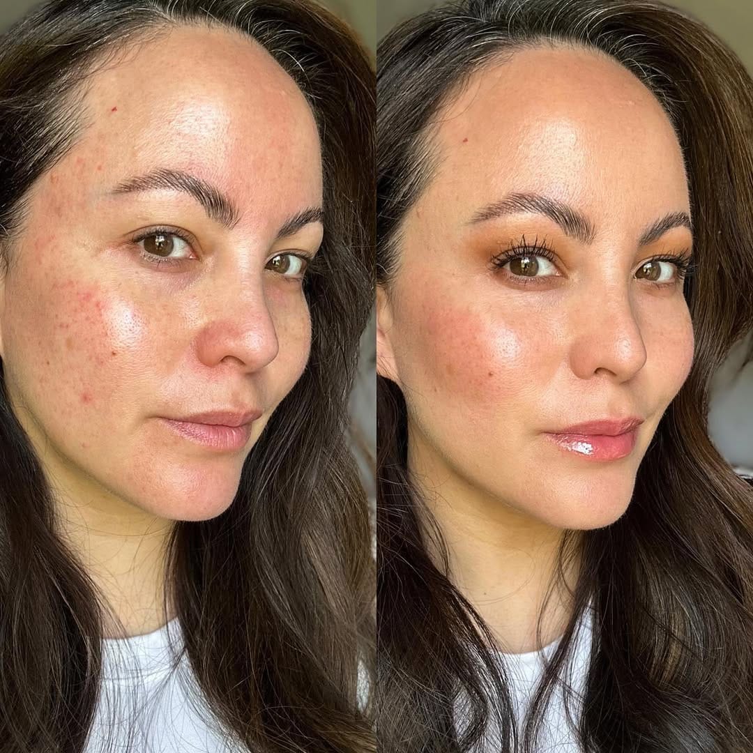 Customer photo review of Nuvee® Changing Foundation