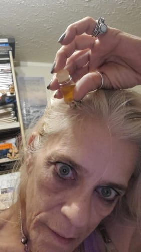 Customer photo review of InspireMist™ Natural Hair Growth Oil