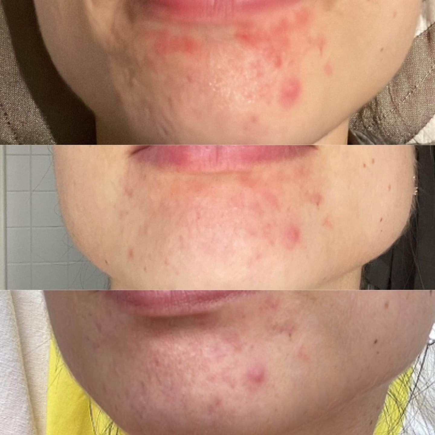 Customer photo review of RUTINA AM&PM - GRANITOS + MARCAS + POROS + MANCHAS + ARRUGAS