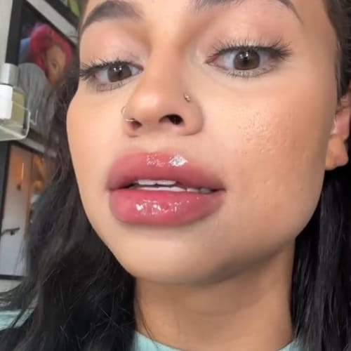 Customer photo review of SUPREME LIPS POWIĘKSZACZ DO UST