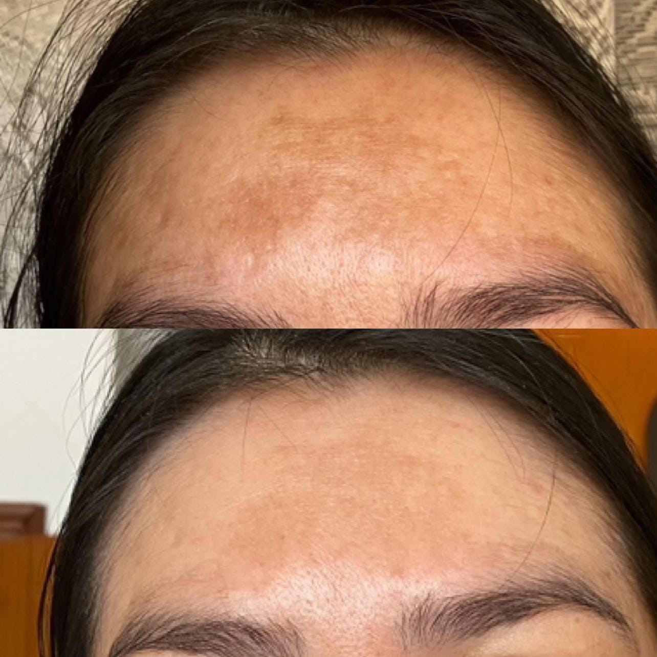 Customer photo review of RUTINA AM&PM - GRANITOS + MARCAS + POROS + MANCHAS + ARRUGAS