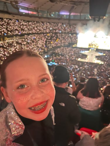 Customer photo review of Gold Glitter Freckles Makeup Patches