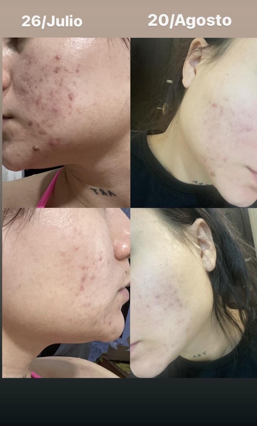 Customer photo review of A.O.X Booster Antioxidante con vitamina C