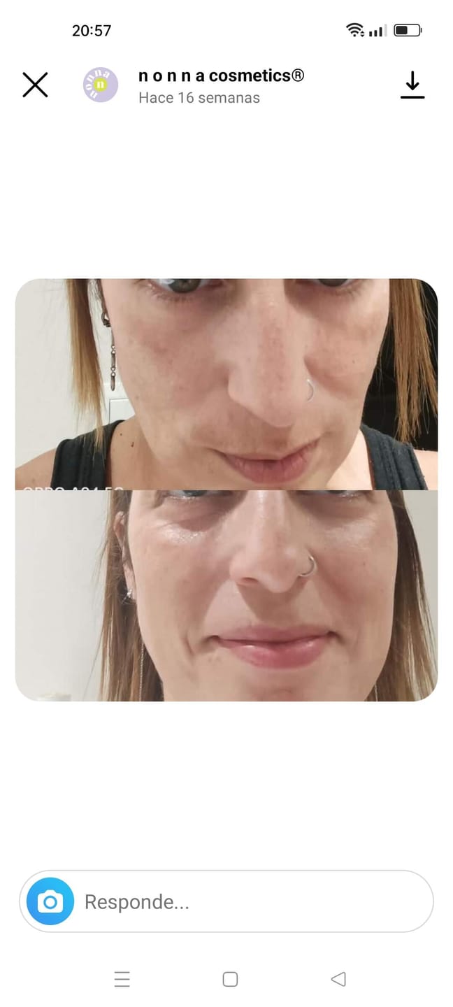 Customer photo review of RUTINA AM&PM - GRANITOS + MARCAS + POROS + MANCHAS + ARRUGAS