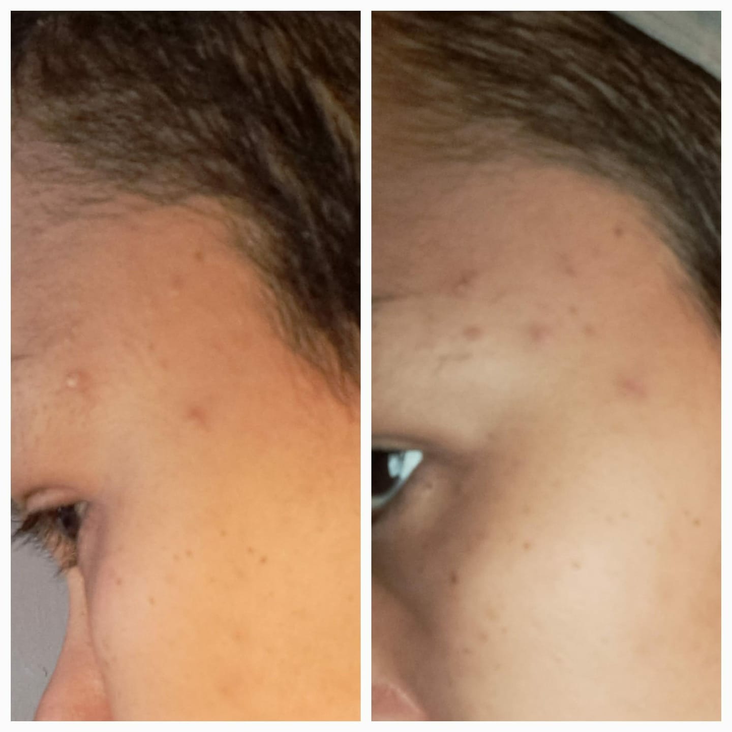 Customer photo review of RUTINA AM&PM - GRANITOS + MARCAS + POROS + MANCHAS + ARRUGAS