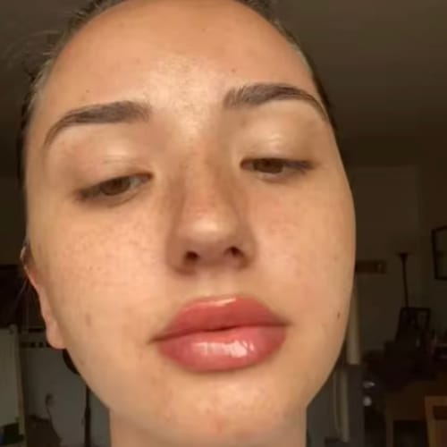 Customer photo review of SUPREME LIPS POWIĘKSZACZ DO UST