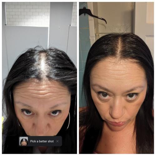 Customer photo review of InspireMist™ Natural Hair Growth Oil