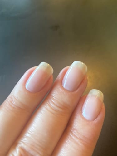 Customer photo review of Conceal & Repair Kit