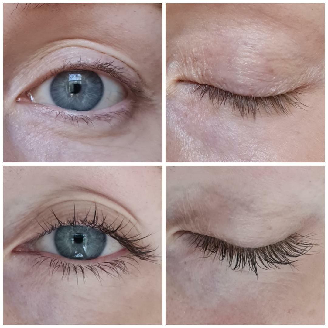 Customer photo review of Eyelash Growth Serum - Original