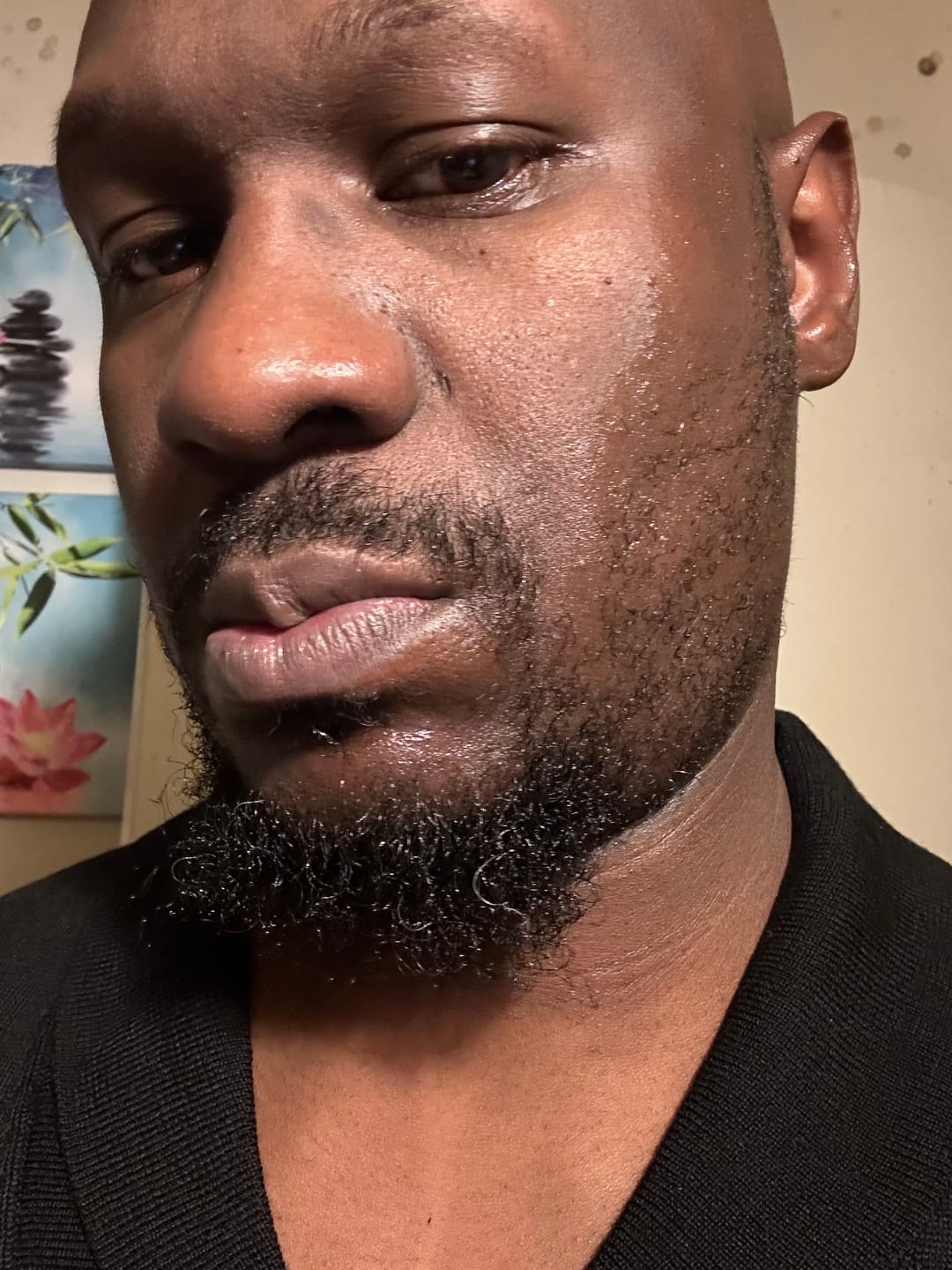 Customer photo review of Beard Growth Magic (Beard Growth Oil)