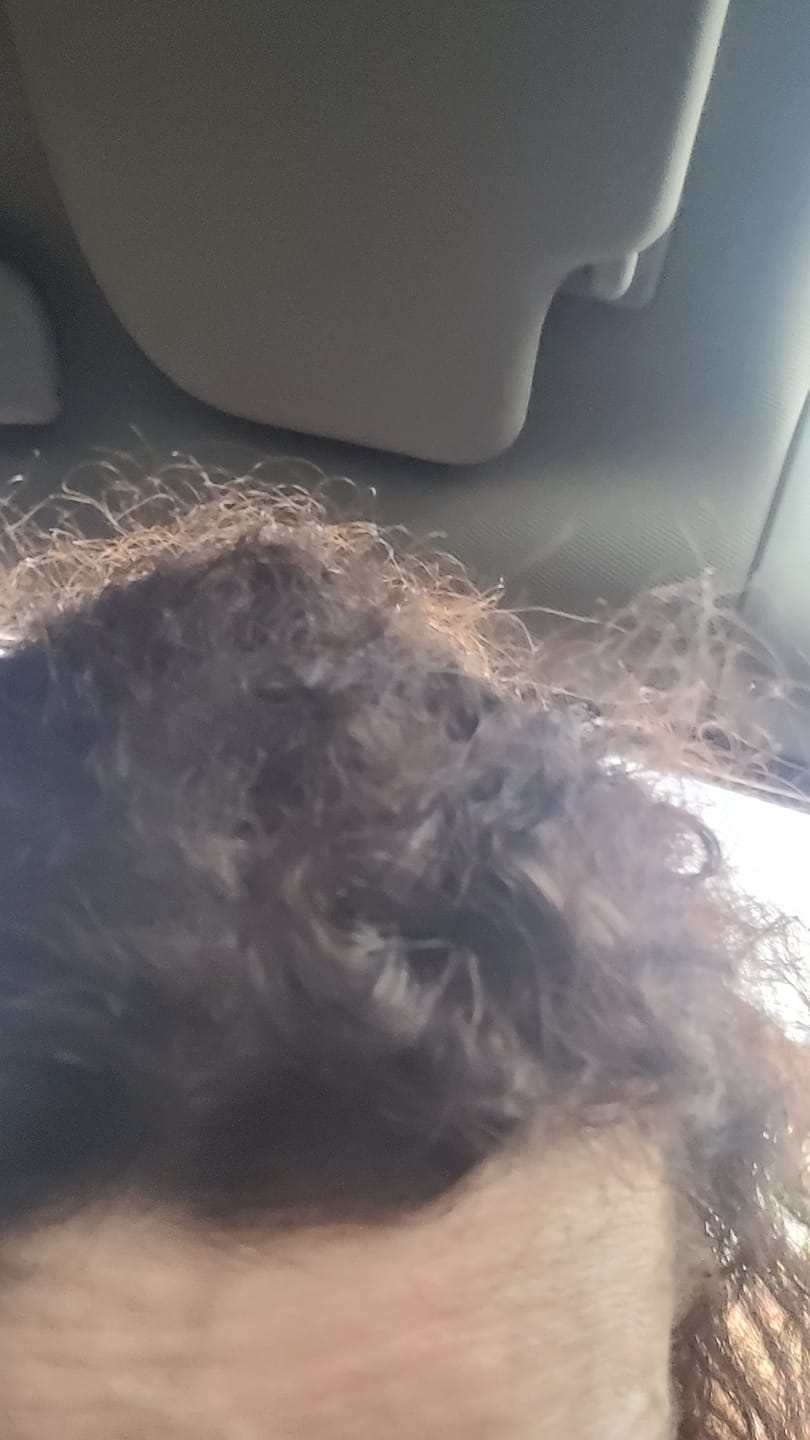 Customer photo review of Shampoo Anticaída
