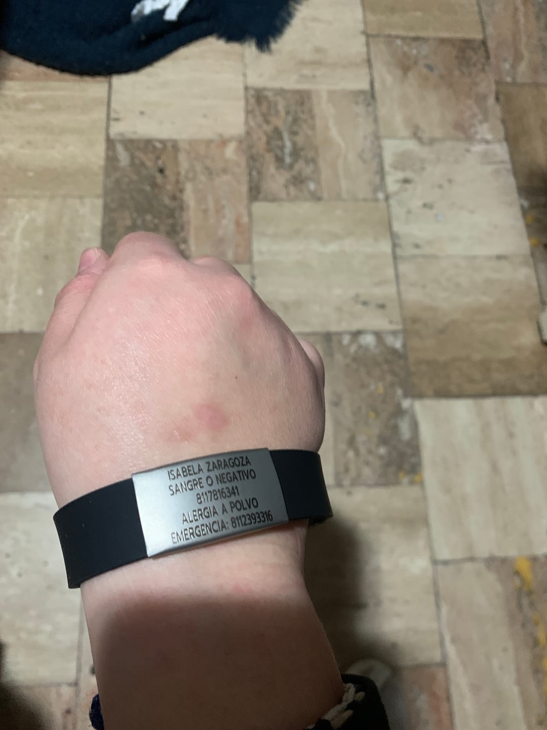 Customer photo review of AxoID - Brazalete de Emergencia