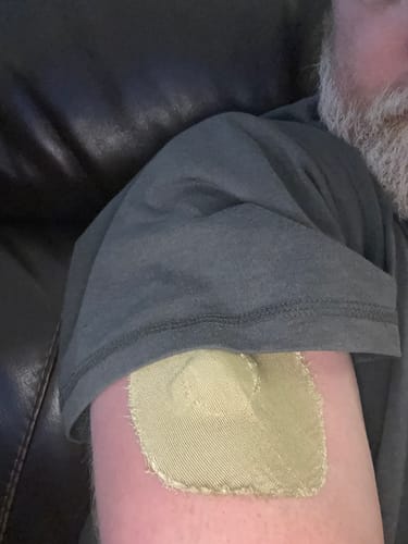 Customer photo review of Skin Grip Original - Medtronic Guardian/Enlite Adhesive Patches