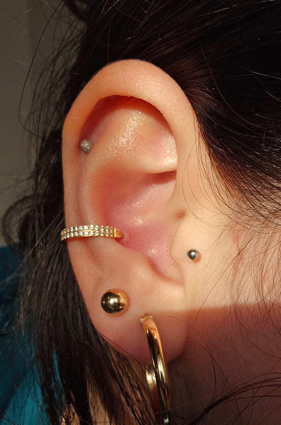 Customer photo review of Double Conch Piercing | Titan